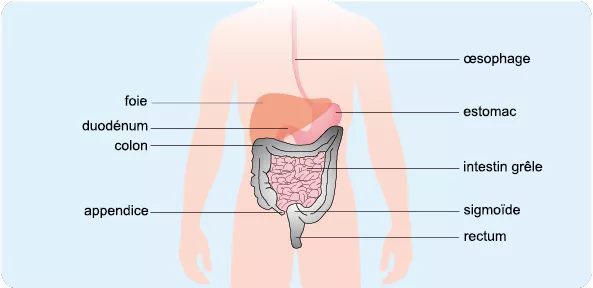 La maladie de Crohn est une inflammation chronique qui peut toucher les parois de tout le tube digestif, de la bouche à l’anus. 
Schéma des organes atteints par la maladie de Crohn.